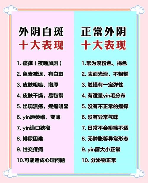 包含妇科有白斑是什么意思严重吗的词条